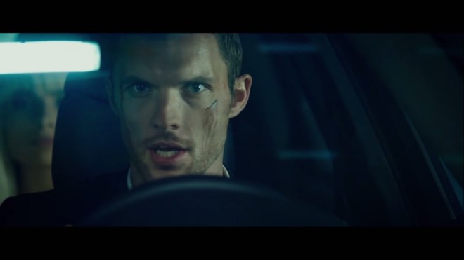 “Dude.  Did you get collagen work or something?”     “NO!  PEOPLE JUST KEEP HITTING ME IN THE FACE!!!”